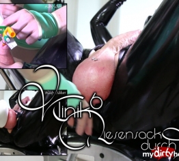 Klinik 6 - Riesensack durch Infusion